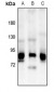 Anti-OLFML2B Antibody